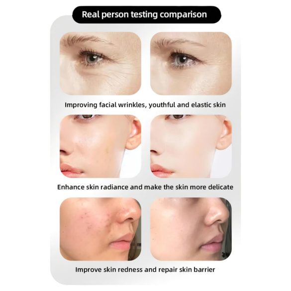 Photonföryngrande Ansiktsvård LED-mask